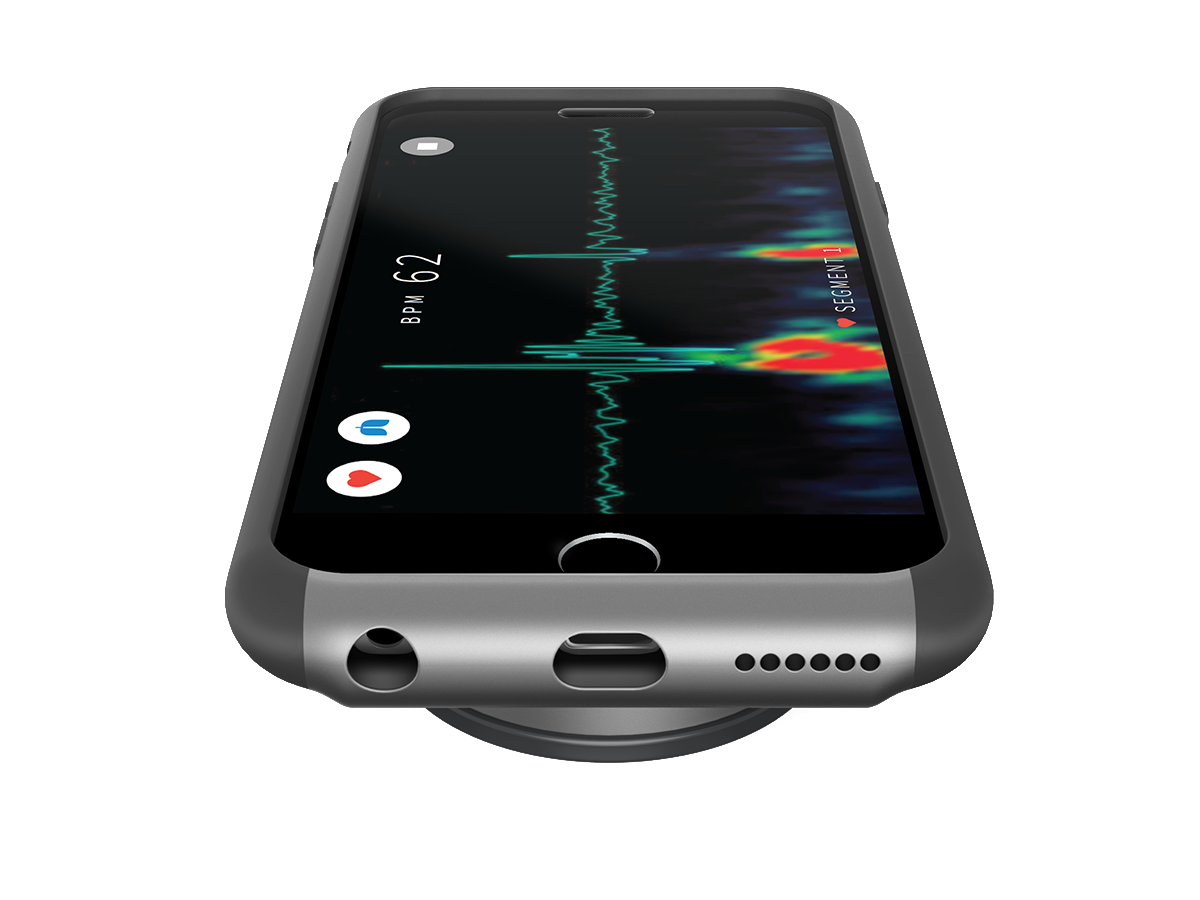 Steth IO The Smartphone Stethoscope